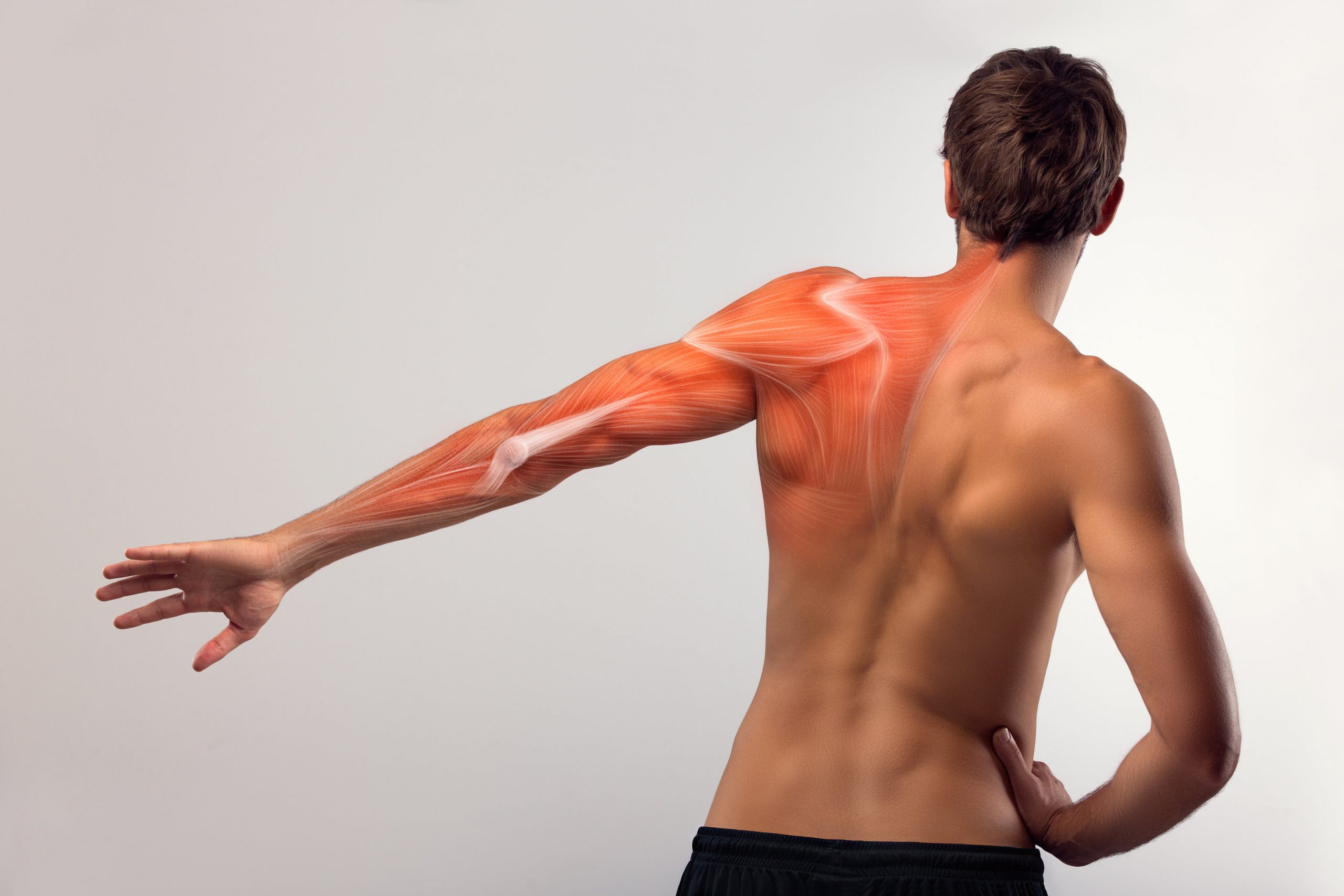 Fisioterapia Madrid 1 Vista posterior anatómica de una espalda y un brazo como lo vería un fisioterapeuta
